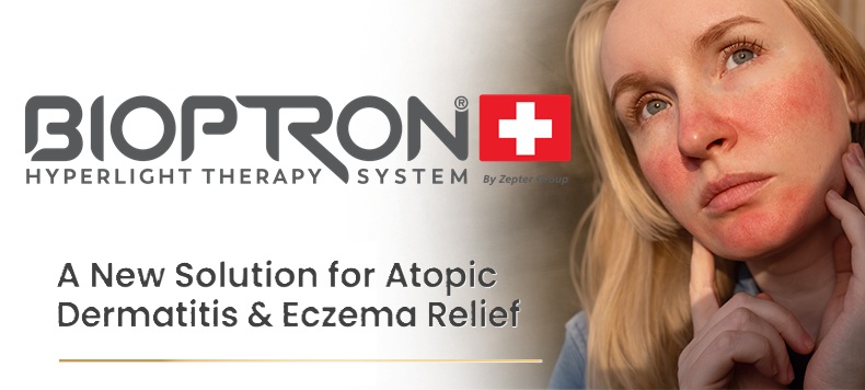 Bioptron Hyperlight Therapy in patients suffering from atopic dermatitis (AD).